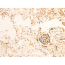 AF3068 staining HeLa by IF/ICC. The sample were fixed with PFA and permeabilized in 0.1% Triton X-100,then blocked in 10% serum for 45 minutes at 25¡ãC. The primary antibody was diluted at 1/200 and incubated with the sample for 1 hour at 37¡ãC. An  Alexa Fluor 594 conjugated goat anti-rabbit IgG (H+L) Ab, diluted at 1/600, was used as the secondary antibod