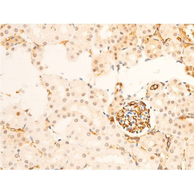AF3068 staining HeLa by IF/ICC. The sample were fixed with PFA and permeabilized in 0.1% Triton X-100,then blocked in 10% serum for 45 minutes at 25¡ãC. The primary antibody was diluted at 1/200 and incubated with the sample for 1 hour at 37¡ãC. An  Alexa Fluor 594 conjugated goat anti-rabbit IgG (H+L) Ab, diluted at 1/600, was used as the secondary antibod