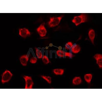 AF0189 staining HepG2 by IF/ICC. The sample were fixed with PFA and permeabilized in 0.1% Triton X-100,then blocked in 10% serum for 45 minutes at 25¡ãC. The primary antibody was diluted at 1/200 and incubated with the sample for 1 hour at 37¡ãC. An  Alexa Fluor 594 conjugated goat anti-rabbit IgG (H+L) Ab, diluted at 1/600, was used as the secondary antibod