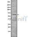 Western blot analysis of extracts from various samples, using Cytochrome P450 4F22 Antibody.
 Lane 1: Hela treated with blocking peptide;
 Lane 2: Hela;
 Lane 3: HepG2.