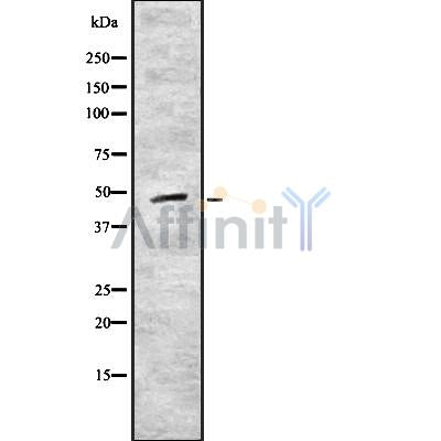 DF8930 at 1/100 staining Human lung cancer tissue by IHC-P. The sample was formaldehyde fixed and a heat mediated antigen retrieval step in citrate buffer was performed. The sample was then blocked and incubated with the antibody for 1.5 hours at 22¡ãC. An HRP conjugated goat anti-rabbit antibody was used as the secondary