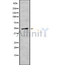 Western blot analysis of extracts from Rat heart, using CRLF3 Antibody. The lane on the left was treated with blocking peptide.