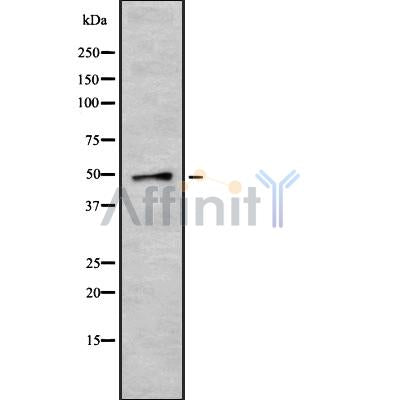 Western blot analysis of extracts from Rat heart, using CRLF3 Antibody. The lane on the left was treated with blocking peptide.