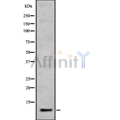Western blot analysis of extracts from Rat heart, using Cytochrome c Oxidase 6A1 Antibody. The lane on the left was treated with blocking peptide.