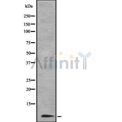Western blot analysis of Cytochrome c Oxidase 6B1 using COLO205 whole cell lysates