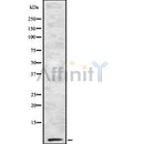 Western blot analysis of Cytochrome c Oxidase 7B2 using RAW264.7 whole cell lysates