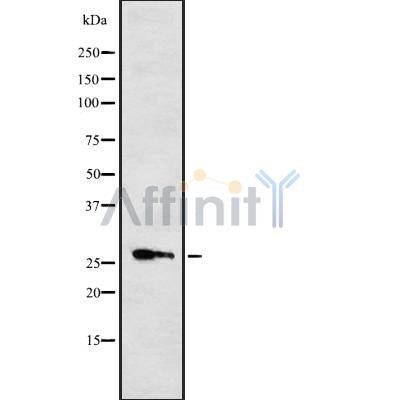 Western blot analysis of Cytochrome b561 using RAW264.7 whole cell lysates