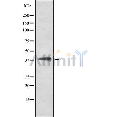 DF8941 at 1/100 staining Mouse lung tissue by IHC-P. The sample was formaldehyde fixed and a heat mediated antigen retrieval step in citrate buffer was performed. The sample was then blocked and incubated with the antibody for 1.5 hours at 22¡ãC. An HRP conjugated goat anti-rabbit antibody was used as the secondary