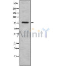 Western blot analysis of HJURP using COLO205 whole cell lysates