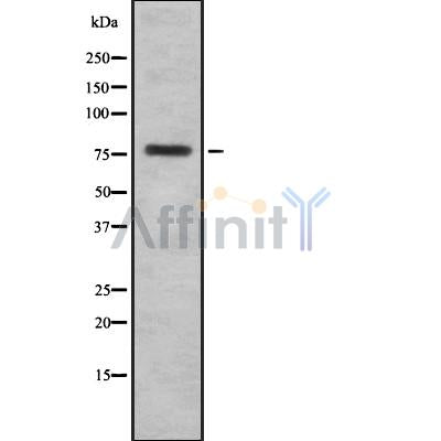 Western blot analysis of HJURP using COLO205 whole cell lysates
