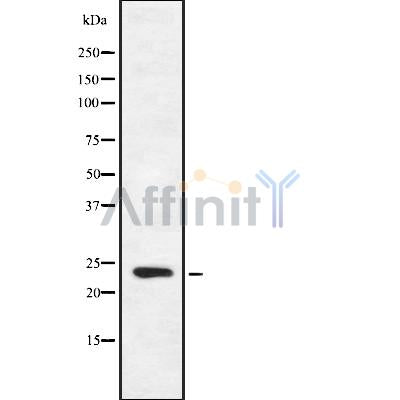 DF8945 at 1/100 staining Mouse kidney tissue by IHC-P. The sample was formaldehyde fixed and a heat mediated antigen retrieval step in citrate buffer was performed. The sample was then blocked and incubated with the antibody for 1.5 hours at 22¡ãC. An HRP conjugated goat anti-rabbit antibody was used as the secondary