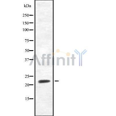 Western blot analysis of extracts from mouse brain, using FGF20 Antibody.