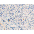 AF3070 staining MDA-MB-231 by IF/ICC. The sample were fixed with PFA and permeabilized in 0.1% Triton X-100,then blocked in 10% serum for 45 minutes at 25¡ãC. The primary antibody was diluted at 1/200 and incubated with the sample for 1 hour at 37¡ãC. An  Alexa Fluor 594 conjugated goat anti-rabbit IgG (H+L) Ab, diluted at 1/600, was used as the secondary antibod
