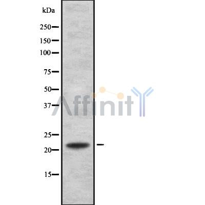 Western blot analysis FGF21 using COLO205 whole cell lysates