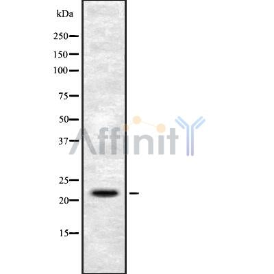 Western blot analysis of extracts from mouse liver, using FGF6 Antibody.