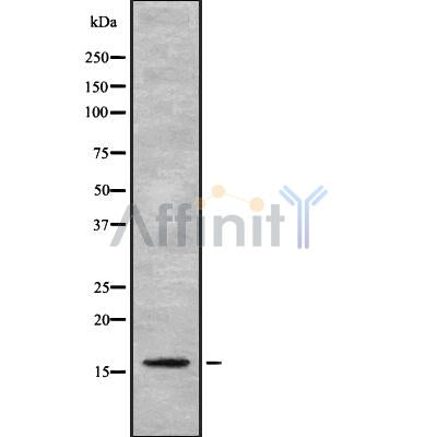 DF8951 at 1/100 staining Mouse kidney tissue by IHC-P. The sample was formaldehyde fixed and a heat mediated antigen retrieval step in citrate buffer was performed. The sample was then blocked and incubated with the antibody for 1.5 hours at 22¡ãC. An HRP conjugated goat anti-rabbit antibody was used as the secondary