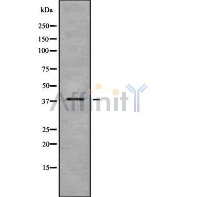 Western blot analysis GPD1 using COLO205 whole cell lysates