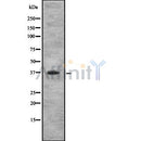 Western blot analysis IL10RB using COLO205 whole cell lysates
