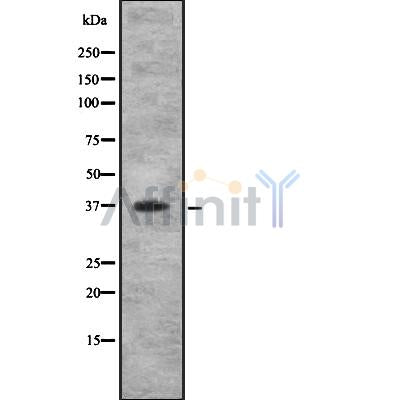 Western blot analysis IL10RB using COLO205 whole cell lysates