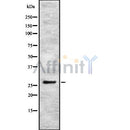 Western blot analysis of extracts from 293, using IBP4 Antibody. Lane 1 was treated with the blocking peptide.