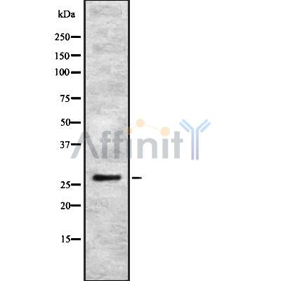 Western blot analysis of extracts from 293, using IBP4 Antibody. Lane 1 was treated with the blocking peptide.
