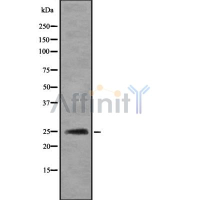 Western blot analysis IBP6 using Jurkat whole cell lysates