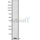 DF8960 at 1/100 staining Human lung tissue by IHC-P. The sample was formaldehyde fixed and a heat mediated antigen retrieval step in citrate buffer was performed. The sample was then blocked and incubated with the antibody for 1.5 hours at 22¡ãC. An HRP conjugated goat anti-rabbit antibody was used as the secondary