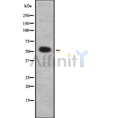DF8962 at 1/100 staining Human cervical cancer tissue by IHC-P. The sample was formaldehyde fixed and a heat mediated antigen retrieval step in citrate buffer was performed. The sample was then blocked and incubated with the antibody for 1.5 hours at 22¡ãC. An HRP conjugated goat anti-rabbit antibody was used as the secondary