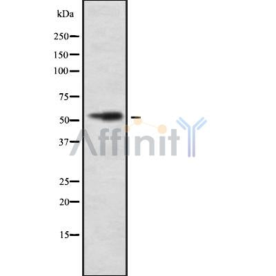 Western blot analysis IFIT3 using Jurkat whole cell lysates