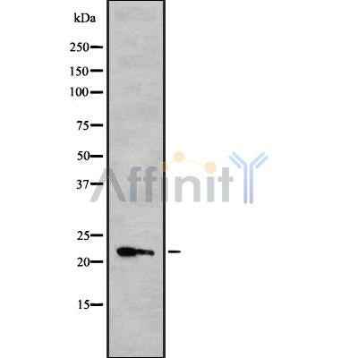 Western blot analysis of extracts from Hela, using IFN10 Antibody. The lane on the left was treated with blocking peptide.