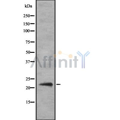 Western blot analysis IFN14 using HeLa whole cell lysates