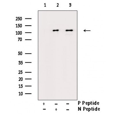 AF3116 staining 293 by IF/ICC. The sample were fixed with PFA and permeabilized in 0.1% Triton X-100,then blocked in 10% serum for 45 minutes at 25¡ãC. The primary antibody was diluted at 1/200 and incubated with the sample for 1 hour at 37¡ãC. An  Alexa Fluor 594 conjugated goat anti-rabbit IgG (H+L) Ab, diluted at 1/600, was used as the secondary antibod