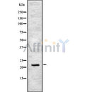 Western blot analysis of extracts from Hela, using IFN17 Antibody. The lane on the left was treated with blocking peptide.