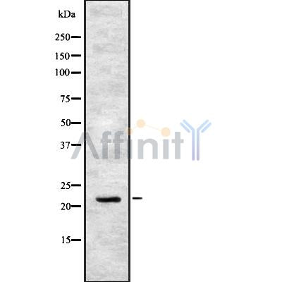 Western blot analysis of extracts from Hela, using IFN17 Antibody. The lane on the left was treated with blocking peptide.