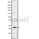 Western blot analysis IFN21 using Jurkat whole cell lysates
