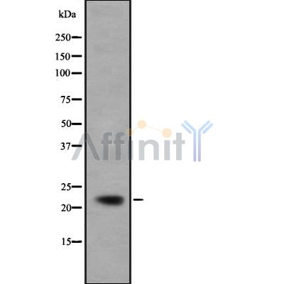 DF8970 at 1/100 staining Mouse kidney tissue by IHC-P. The sample was formaldehyde fixed and a heat mediated antigen retrieval step in citrate buffer was performed. The sample was then blocked and incubated with the antibody for 1.5 hours at 22¡ãC. An HRP conjugated goat anti-rabbit antibody was used as the secondary