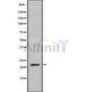 Western blot analysis IFNA6 using HeLa whole cell lysates