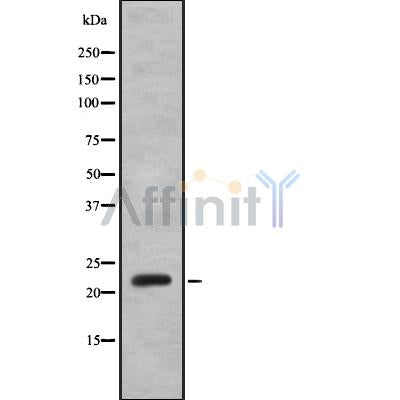 Western blot analysis IFNA8 using K562 whole cell lysates