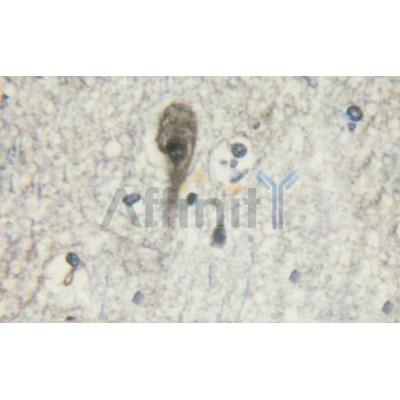 AF3117 at 1/100 staining Mouse muscle tissue by IHC-P. The sample was formaldehyde fixed and a heat mediated antigen retrieval step in citrate buffer was performed. The sample was then blocked and incubated with the antibody for 1.5 hours at 22¡ãC. An HRP conjugated goat anti-rabbit antibody was used as the secondary