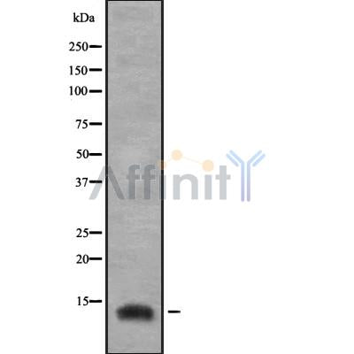Western blot analysis of extracts from Mouse  brain, using IGFL3 Antibody. The lane on the left was treated with blocking peptide.

Observed bands: 20 kDa.