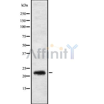 DF8980 at 1/100 staining Human Melanoma tissue by IHC-P. The sample was formaldehyde fixed and a heat mediated antigen retrieval step in citrate buffer was performed. The sample was then blocked and incubated with the antibody for 1.5 hours at 22¡ãC. An HRP conjugated goat anti-rabbit antibody was used as the secondary