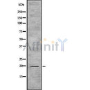 Western blot analysis IL19 using HeLa whole cell lysates
