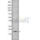 Western blot analysis IL31 using HT29 whole cell lysates