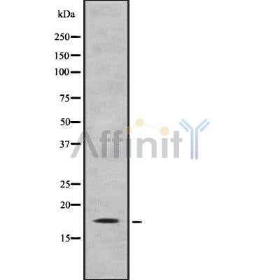 Western blot analysis IL31 using HT29 whole cell lysates