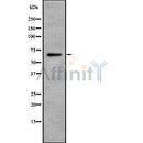 Western blot analysis ILRL2 using HuvEc whole cell lysates