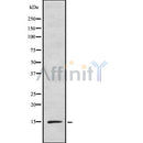 Western blot analysis of extracts from Hela, using INSL5 Antibody. The lane on the left was treated with blocking peptide.