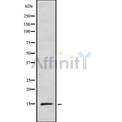 Western blot analysis of extracts from Hela, using INSL5 Antibody. The lane on the left was treated with blocking peptide.