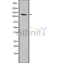 Western blot analysis ITGA11 using A549 whole cell lysates