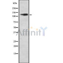 Western blot analysis ITGAD using COLO205 whole cell lysates