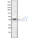 Western blot analysis ITBP2 using Jurkat whole cell lysates